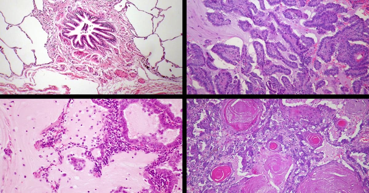 Albumentations in Medical Imaging: Who Actually Uses It
